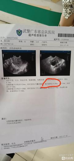 促排五天卵泡多少算正常