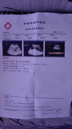 怀孕四个月怎么看男女
