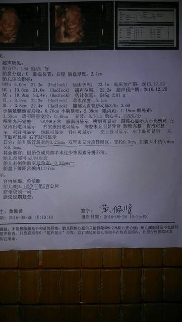 胎儿肾盂扩张是男孩吗