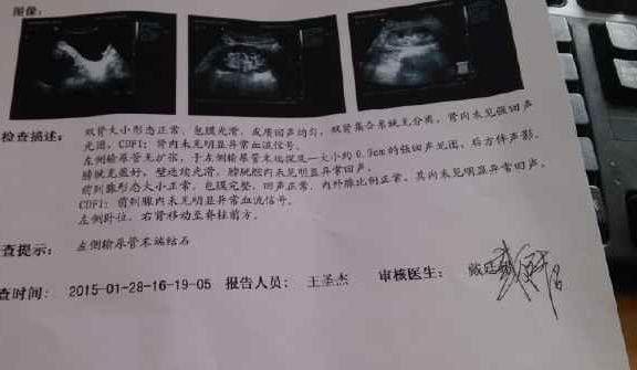怎样检查胎儿是否缺氧