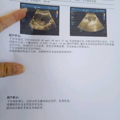 两个月堕胎