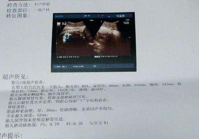 怀孕着床晚是什么意思