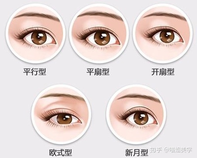 埋线双眼皮的价钱