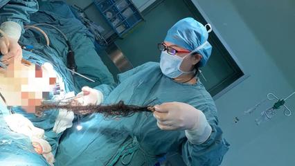 新生儿腹腔囊肿