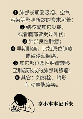 肺部结节怎么治疗