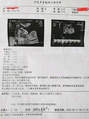 2岁宝宝心率
