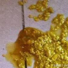 宝宝拉蛋花样大便