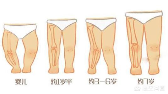 正常宝宝的肋骨图片