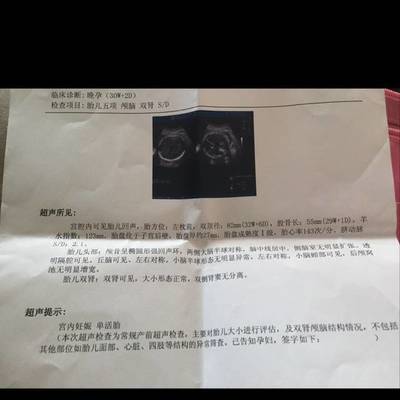 小排畸有宝宝照片吗