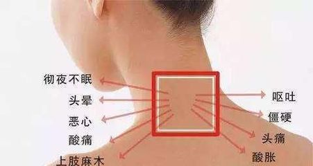 胳膊一直麻是怎么回事