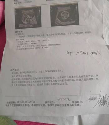 怀孕6个多月胎动少正常吗