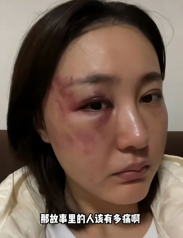 面部轻伤