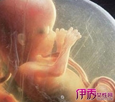 怀孕4个月宝宝多大