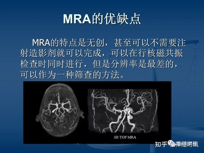 mra和cta的区别