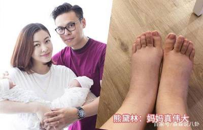 月子10天可以出门吗
