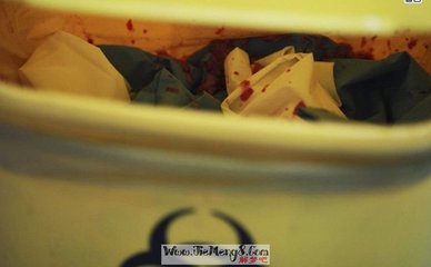 怀孕梦到流产了