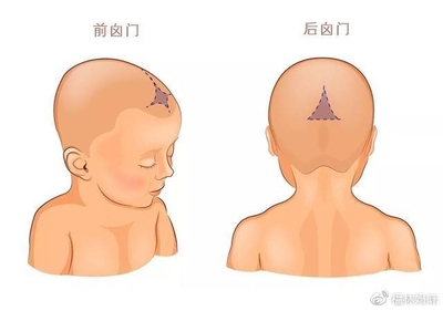 宝宝后卤门图片