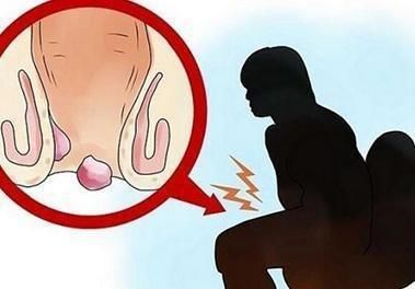 小便出血是怎么回事男