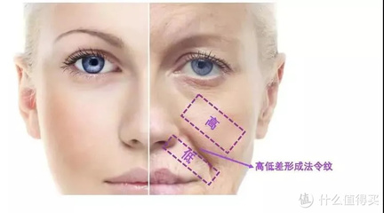 法令纹是