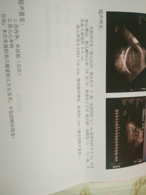 胎儿发育畸形