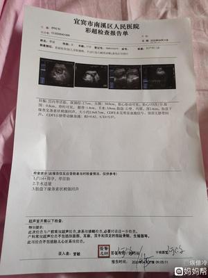 怀孕四个月了腰疼怎么回事