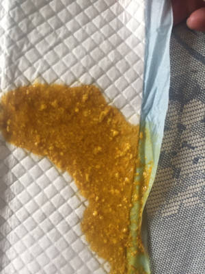 两个月宝宝一天大便几次正常