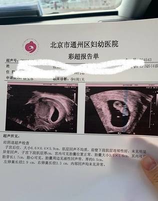 孕8周出血孕囊排出怎么办