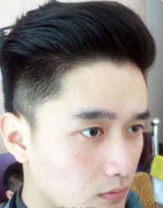 瓜子脸头型