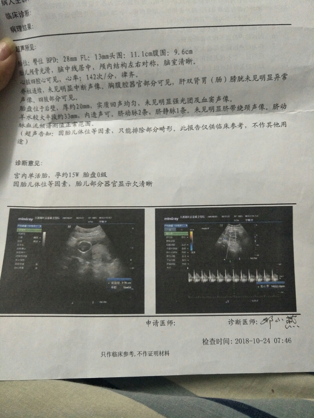 怀孕15周可以做人流吗