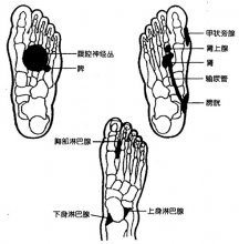 脚底湿疹怎么治疗