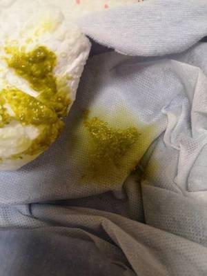 宝宝拉粑粑绿色