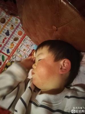 宝宝脸发红发烫怎么回事