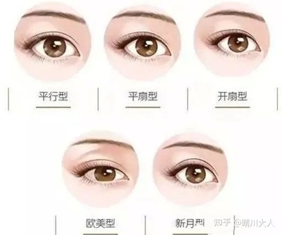 好看的内眦双眼皮