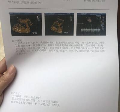 怀孕12周胎儿会动吗