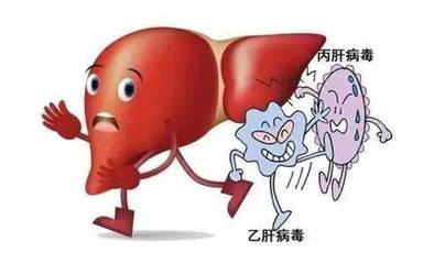 肝炎怎么治疗最好的方法