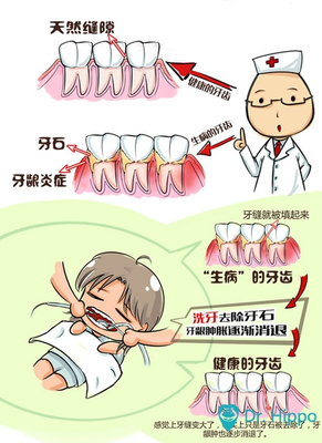 洗牙怎么洗用什么洗