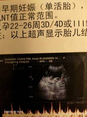 怀孕26周胎儿有多大