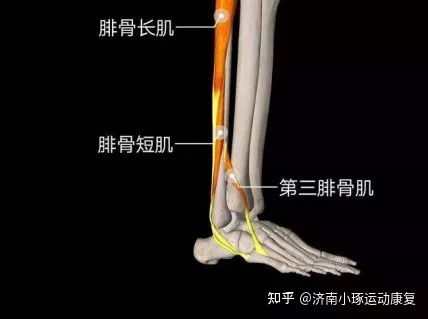 腓骨痛是怎么回事