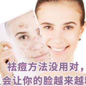 西安哪里可以治痘痘