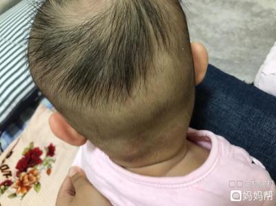 宝宝几个月妈妈开始掉头发