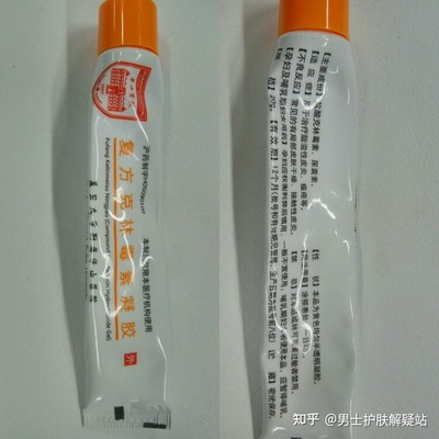 祛痘印的药膏有哪些