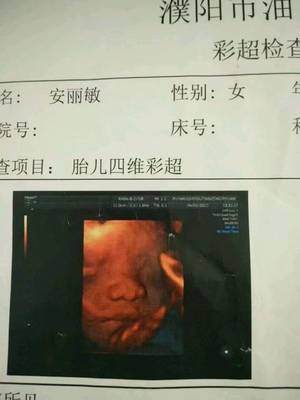 怀孕6个多月胎动少正常吗