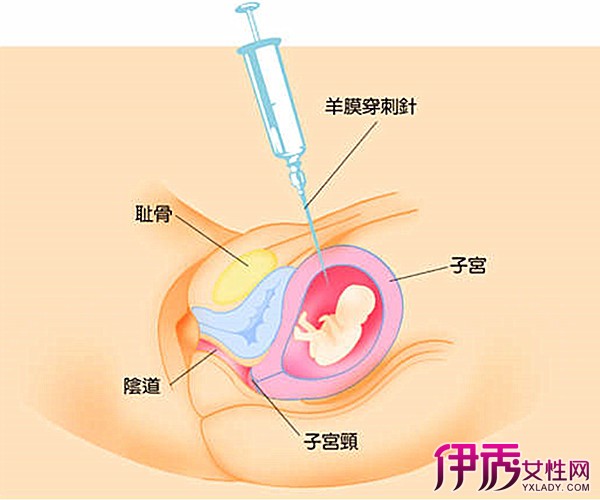 产前dna亲子鉴定