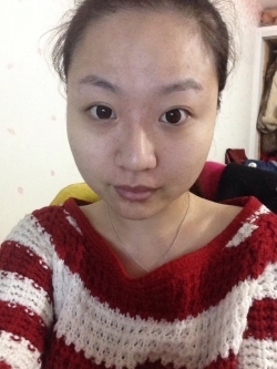 整脸型磨骨整形