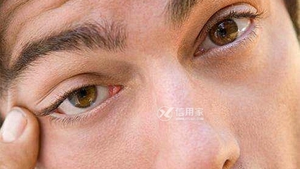 眼一直跳是怎么回事
