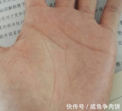婚姻线有痣