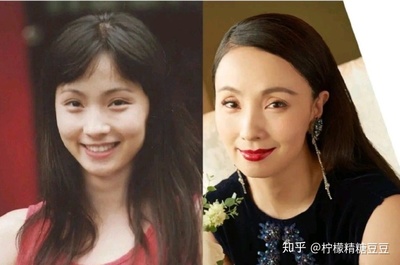 割了双眼皮后特后悔