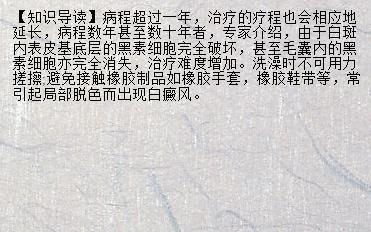 怎么治疗甲亢最快