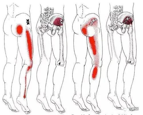 屁股中间痛是怎么回事