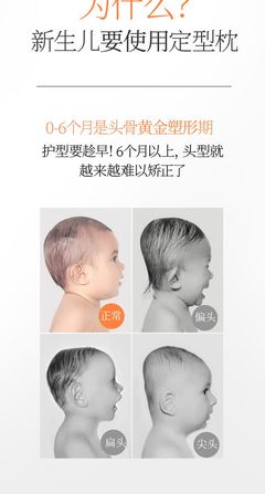 6个月宝宝头型是否定型